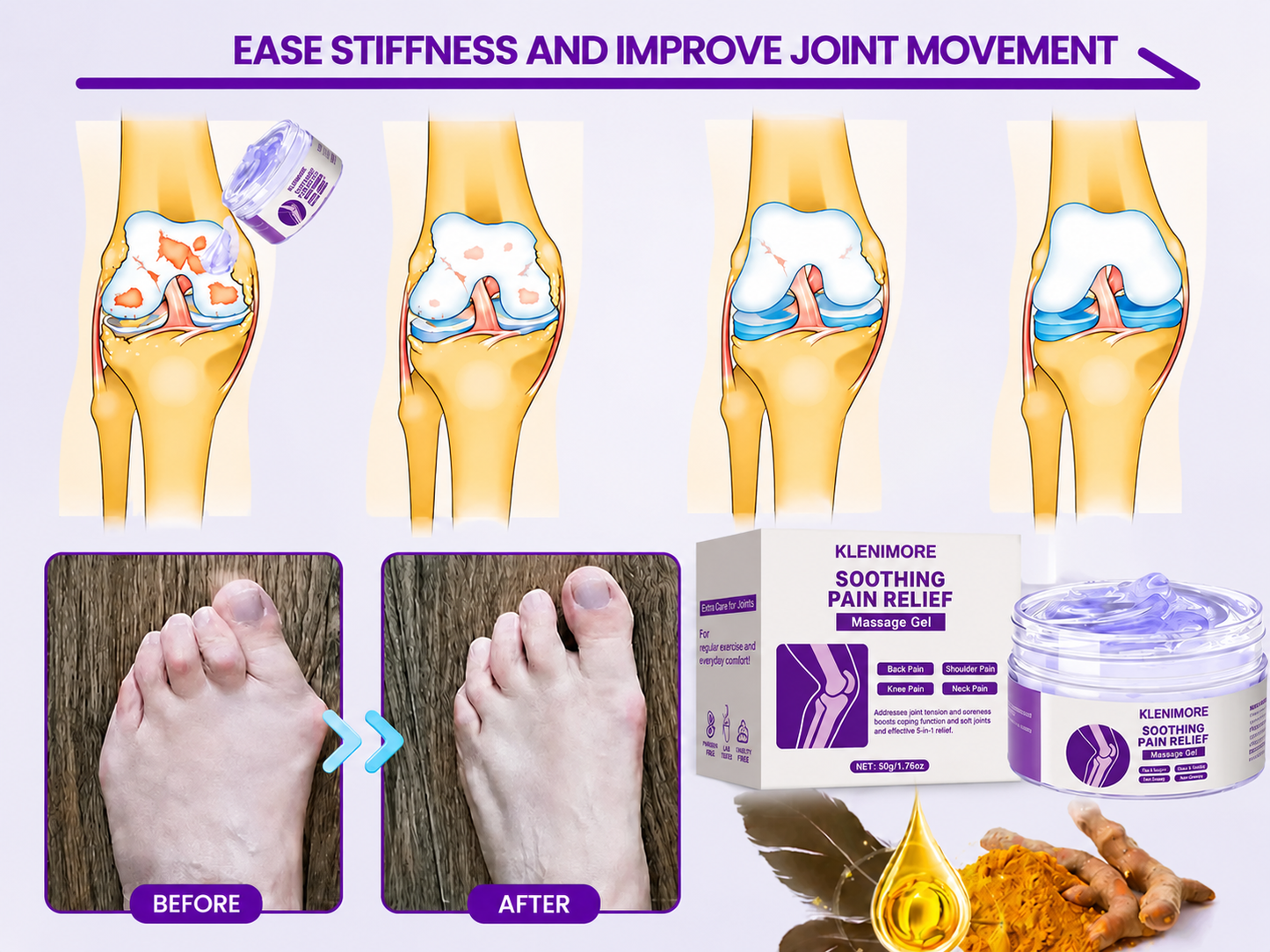 Clinically Trusted Arthritis Pain Relief Gel AAOS-Approved Turmeric & Emu Oil