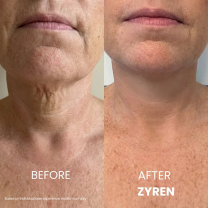 KLENIMORE® Tighten & Lift Neck Cream