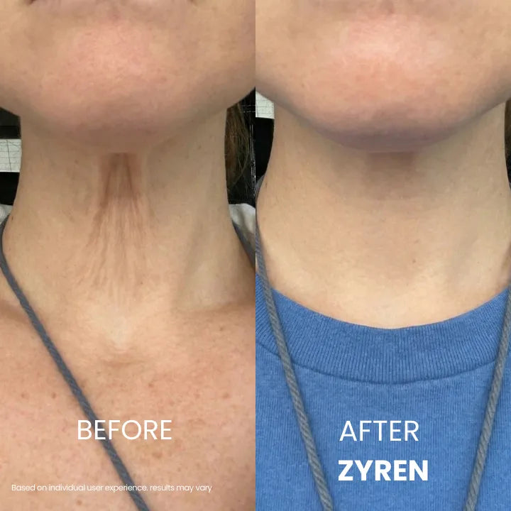 KLENIMORE® Tighten & Lift Neck Cream