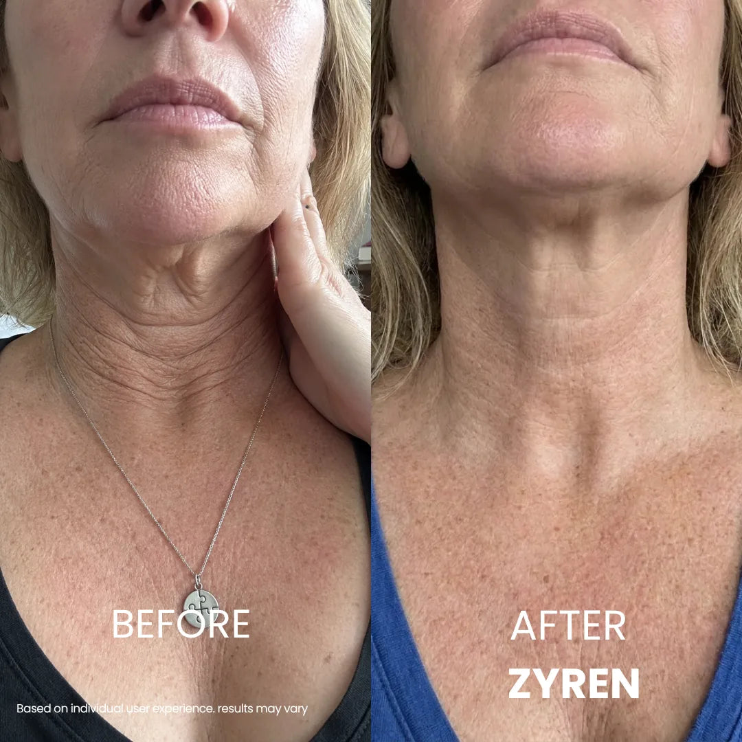KLENIMORE® Tighten & Lift Neck Cream