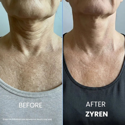 KLENIMORE® Tighten & Lift Neck Cream